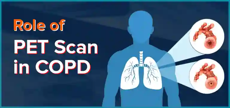 Role of PET scan in COPD: Uses, Preparation, Procedure & Cost